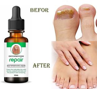 MILAN Enterprise Nails Strong Oil For Cuticle Care, Nail Growth & Strength Men & Women