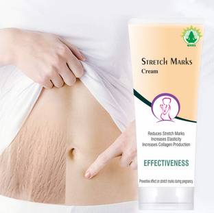 wvhc Stretch Mark Cream, Removes Pregnancy stretch marks, Moisturizing Cream Women