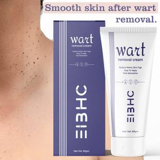 EIBHC Wart Removal Cream r Men & Women