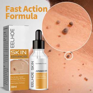Kudh Products Skin Tag Remover Serum – Fast-Acting & Painless Mole & Wart Removal Men & Women