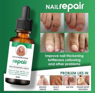 VIVAGLO Onychomycosis Nail growth oil fast, nail strong oil, nail strong serum- Brown Men & Women
