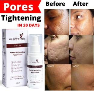 Glowrino cares Pores minimizing face toner for open pores skin Men & Women