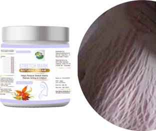 Natural ambience hub Stretch Mark Creams to Remove dark scl Men & Women