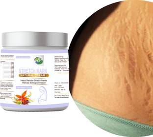Natural ambience hub Stretch Marks Cream for Reducing Stretch Marks Men & Women
