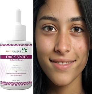 7days natural Dark Circle Remover Dark Removal Serum� anti pimple Reduces� Acne & Blemishes Men & Women