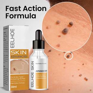 GUDAPATI Skin Tag Remover Serum – Fast & Painless Removal for Skin Tags Men & Women