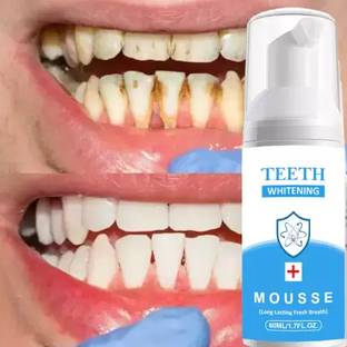 Quprak Teeth Whitening Foam To Removes Bad Breath Fights Germs - Mint Flavor Teeth Whitening Kit