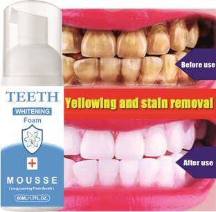 Prifakt Teeth Brighting Toothpaste For Your Smile With Our Teeth Whitening Foam Toothpaste