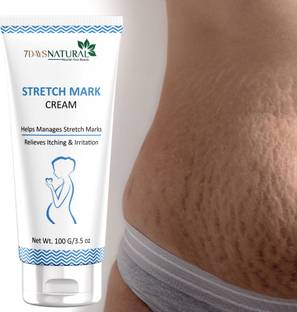 7days natural Stretch Marks Removal Cream for Remove dark spot circles, Acne Blemishes Intimate Cream