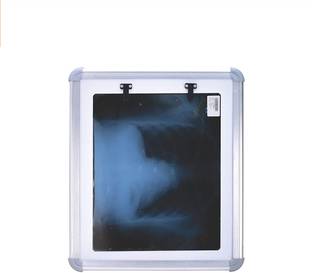 MCP Healthcare Single Film X-Ray View Box Automatic Film and With dimmer to adjust Brightness X-Ray Viewer