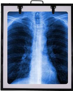 Sanjivani NA X-Ray Viewer