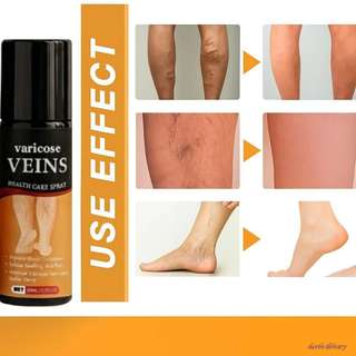 Herbs Library Vericose Vein Spray | Flexibility Support For Herbal ...