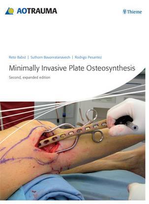 AO Minimally Invasive Plate Osteosynthesis (MIPO) 2nd  Edition