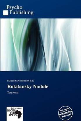 Rokitansky Nodule