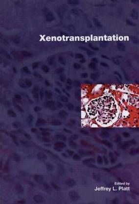 Xenotransplantation