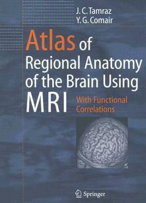 Atlas of Regional Anatomy of the Brain Using MRI