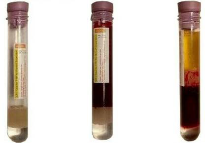 REJSOL PRP Tube