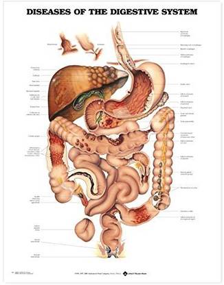 Generic Diseases Of The Digestive System Anatomical Chart