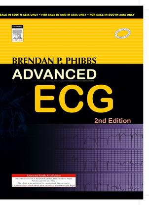 Advanced ECG