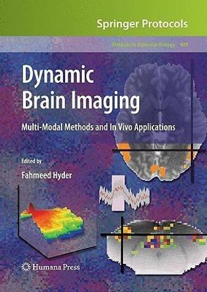 Dynamic Brain Imaging