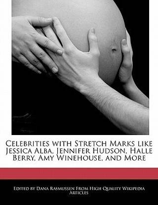 Celebrities with Stretch Marks Like Jessica Alba, Jennifer Hudson, Halle Berry, Amy Winehouse, and More