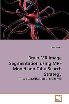 Brain MR Image Segmentation using MRF Model and Tabu Search Strategy