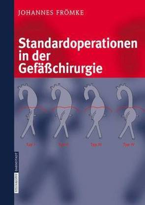 Standardoperationen in der Gefaesschirurgie