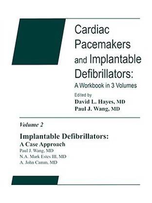 Implantable Defibrillators: A Case Approach
