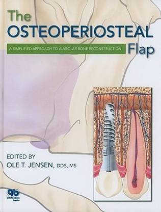The Osteoperiosteal Flap