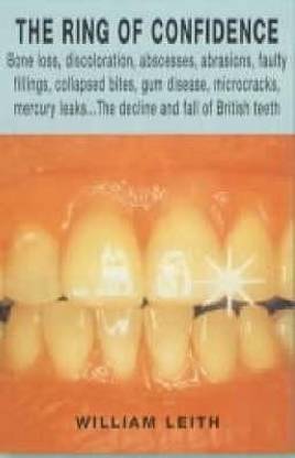 British Teeth