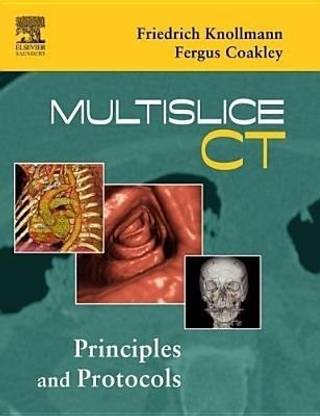 Multislice CT