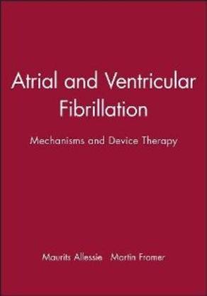 Atrial and Ventricular Fibrillation