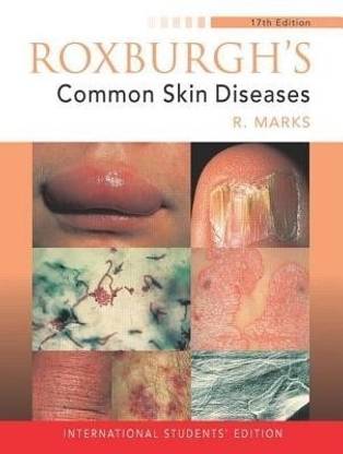 Roxburgh's Common Skin Diseases, 17Ed