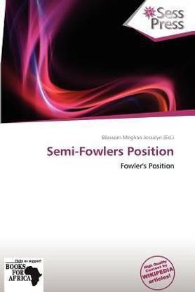 Semi-Fowlers Position