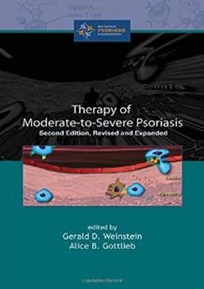 Therapy of Moderate-to-Severe-Psoriasis, Second Edition