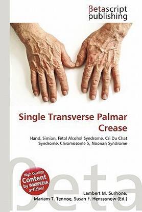 Single Transverse Palmar Crease