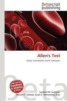 Allen's Test