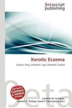 Xerotic Eczema