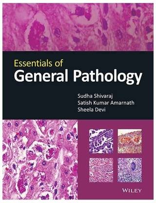 Essentials of General Pathology