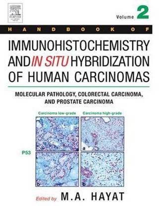Handbook of Immunohistochemistry and in Situ Hybridization of Human Carcinomas