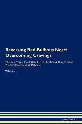 Reversing Red Bulbous Nose