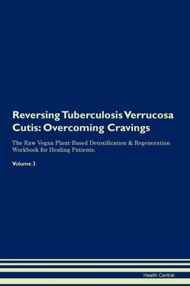 Reversing Tuberculosis Verrucosa Cutis