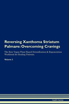Reversing Xanthoma Striatum Palmare