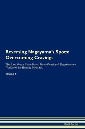 Reversing Nagayama's Spots