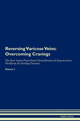 Reversing Varicose Veins