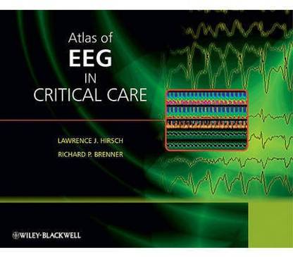 Atlas of EEG in Critical Care