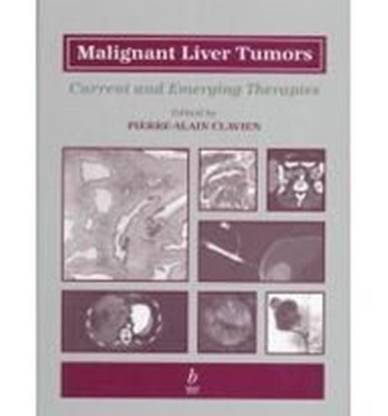 Malignant Liver Tumors