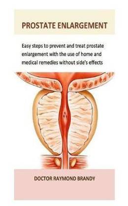 Prostate Enlargement