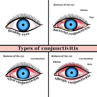 netra churma Surma Powder / Eye Infection/Cleaner Powder pack of 6