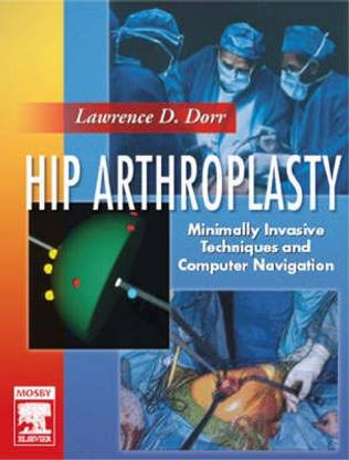 Hip Arthroplasty
